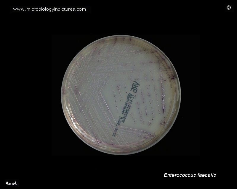 vancomycin resistant Enterococcus faecalis colonies